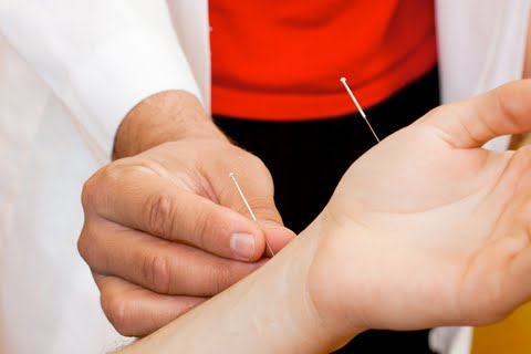 acupuncture for diabetes