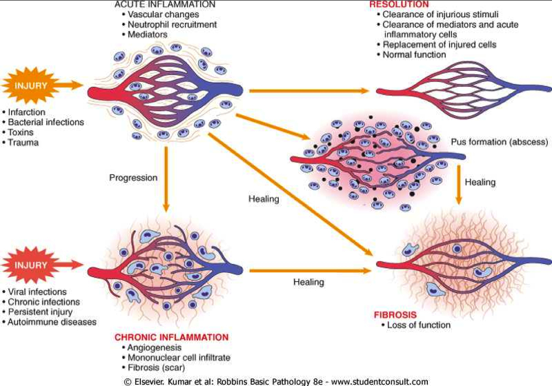 inflammation